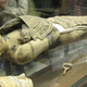 Illustration for article titled Powdered Mummy, Gladiator Blood, and other Historical Medicines Made from Human Corpses